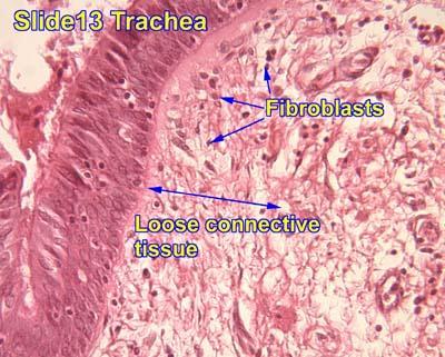 Τραχεία Ίνες κολλαγόνου Ινοβλάστες Χαλαρός Συνδετικός ιστός