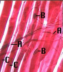 Νεύρωση των γραμμωτών (σκελετικών) μυών: από εξειδικευμένους νευρώνες οι