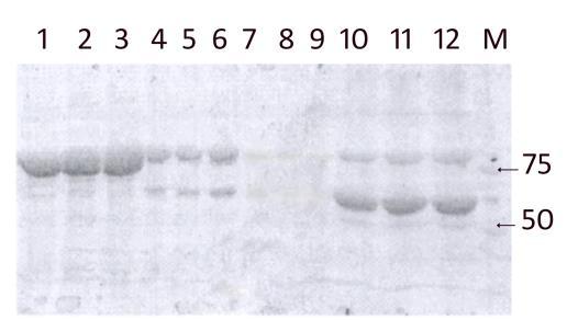 Rezultati sadržavala same proteinske komponente, bez dodatka liganda. Rezultat je prikazan na slici 4.22.