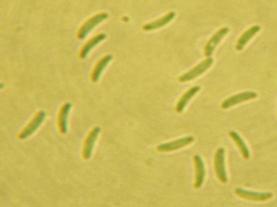 Конидиje гљиве Cytospora prunorum Photo 4.