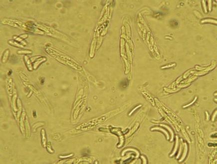 Cross section across picnid of fungus C.