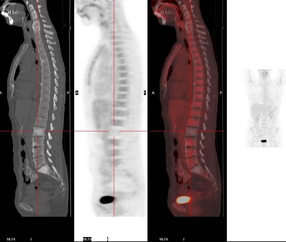 Dss 1: πλήρης