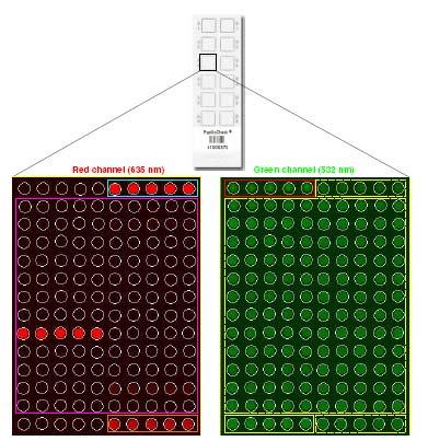 Εικ. 21 Σκανάρισμα του πλακιδίου σε μήκος κύματος 532 nm (πράσινο) και 635 nm (κόκκινο) όπου φαίνονται τα σημεία ελέγχου και τα εξειδικευμένα ανά τύπο HPV ολιγομερή. (Ανατύπωση από www.greinerbioone.