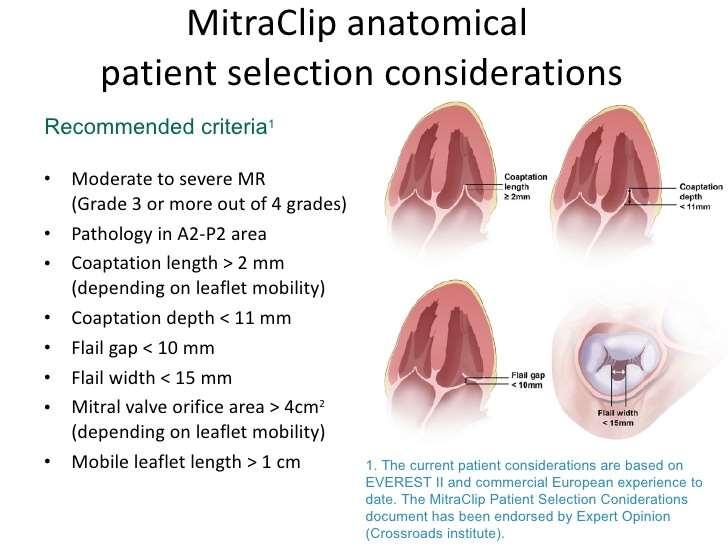 MITRACLIP