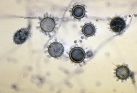 Histoplasma capsulatum Μύκητας εδάφους εμπλουτισμένου με κόπρανα πουλιών νυχτερίδων Μυκήλιο με