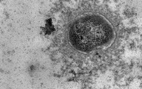 Pasteurella spp Louis Pasteur 1880 Μικροσκοπική