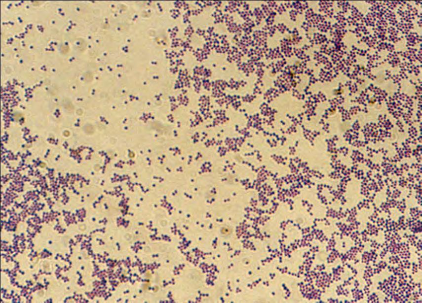 Είδη σταφυλοκόκκων που εμπλέκονται σε SSTIs Staphylococcus