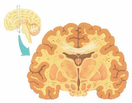 Longitudinalna fisura Moždana kora Corpus callosum Bočna komora Talamus