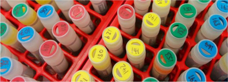 All SYNkinase library arrays are manufactured using REMP 96 well plates