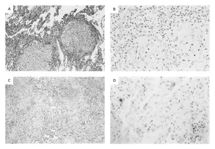 TNF a αναστολείς μάλλον ΝΑΙ TNF alpha inhibitors σχετίζονται με κίνδυνο για σοβαρή λοίμωξη?