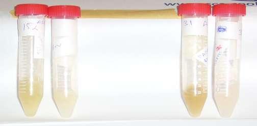 Improvement in sputum quality (purulent- mucopurulent- mucoid) COLISTIN (n=18) TOBRAMYCIN (n=17) PLACEBO (n=17) Sputum