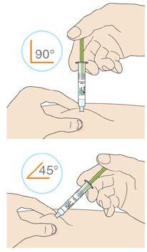 Χρησιμοποιήστε γωνία 45º εάν μπορείτε να ανασηκώσετε μόνο 2 εκ. του δέρματος. Πιέστε το έμβολο προς τα κάτω.