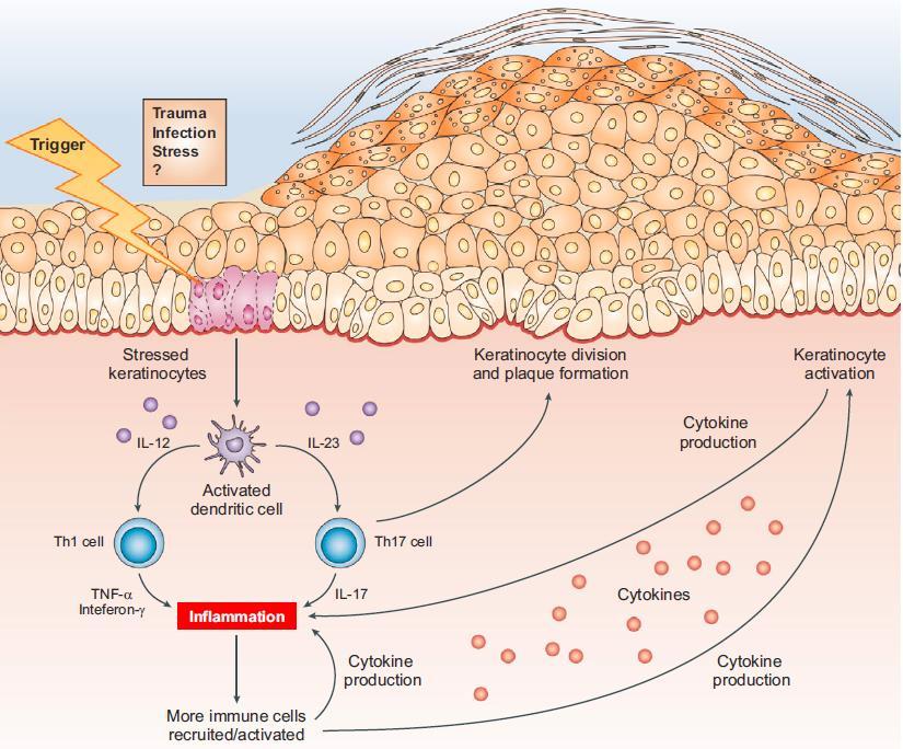 Παθογένεια της ψωρίασης Reprinted by permission from Macmillan Publishers Ltd: [NATURE]