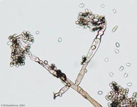 τον παθογόνο µύκητα Botrytis cinerea.