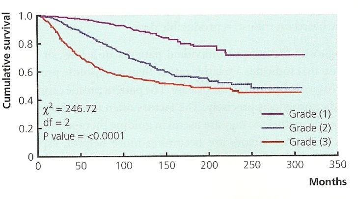 Ιστολογικό grade Σύμφωνα με το σύστημα Bloom και Richardson [162] με την τροποποίηση του Nottingham [163, 164], ο βαθμός κακοήθειας των όγκων του μαστού καθορίζεται από τα αρχιτεκτονικά