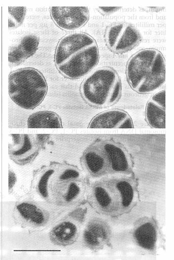 Phase III SAB/IE study Clinical success* in S. aureus-infected patients: mitt population Patients (%) 50 40 30 20 10 0 48.6 44.6 44.4 33/74 34/70 20/45 14/44 MSSA (n=144) Difference in success rates: 4.