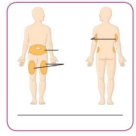 4d Brațe superior posterior Abdomen Coapse Față Spate Zone ale corpului pentru injectare Vă puteţi