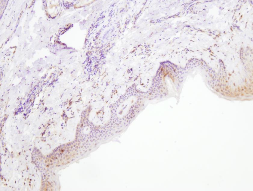 Слика 25. Слабо изражена експресија COX2 у ретроаурикуалрној кожи. Имунореактивност фокално присутна у епителу (увеличање 100х).