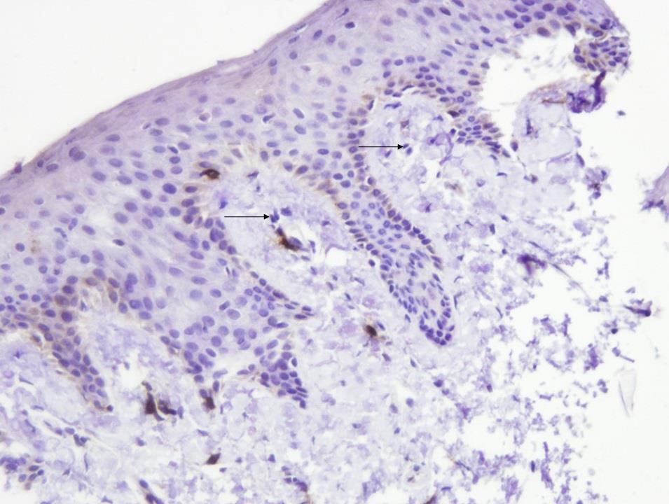 Слика 29. Појединачни Т лимфоцити (црне стрелице) експримовани CD4 маркером у ретроаурикуларној кожи (увеличање 200х).