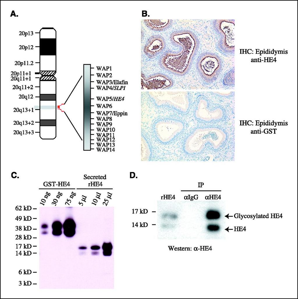 cdna και των όλιγο-νουκλεοτιδικών microarray αναλύσεων σε ωοθηκικούς καρκίνους είχε ως αποτέλεσμα την αναγνώριση πολλών γονιδίων (WFDC2, MSLN, Mucin1, EpCAM, CD9) που υπέρ-εκφράζονται σε πρωτοπαθή
