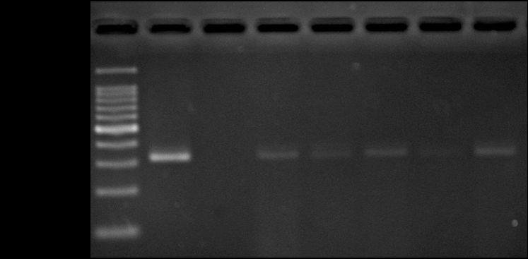 (Kalazar Detect TM, rk39 dipstick) rk39 DNA DNA ITS PCR (ITS-PCR) (2) 1 3 L.
