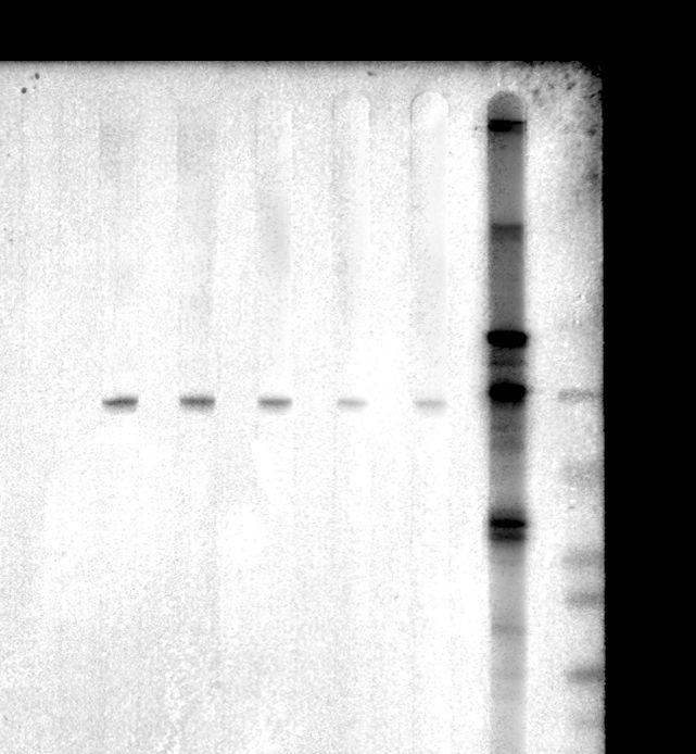 5. CD4 + CD25 + Foxp3 + (Treg)CD4 + T. 3 HE 3 1 90 kda 8 690 kda 6.. (PC).1235 8 01m2m3m5m8m 100 2 HRP protein G ECL Plus TM. 2 1 2 4 PCR 2 DNA 8 L. donovani (3) L.