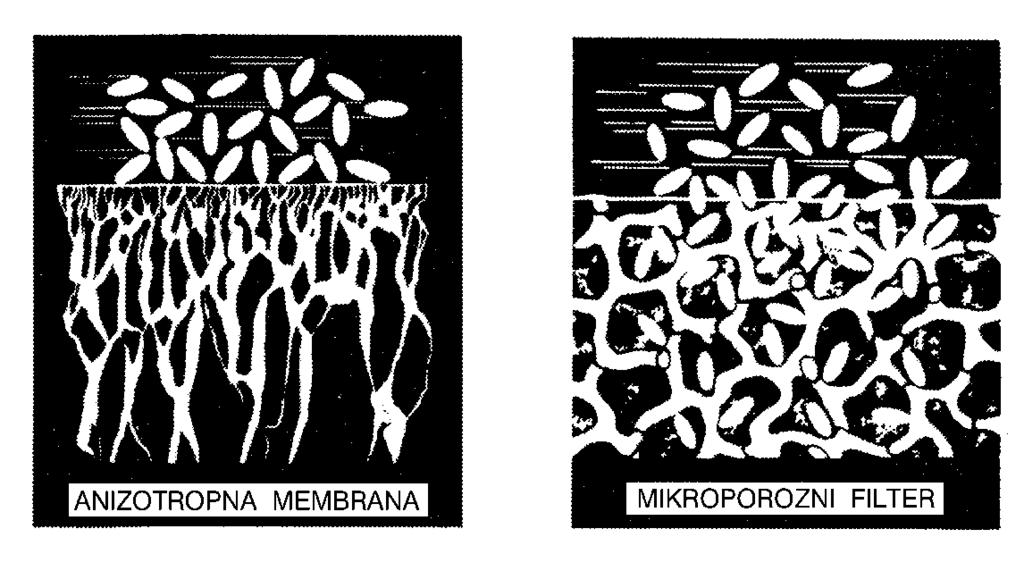 membrana Simetrična in nesimetrična