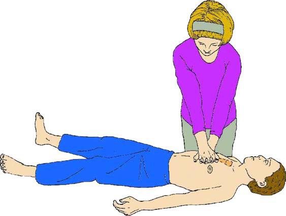 Po 1 min volaj resuscitačný tím, potom pokračuj v KPR Obrázok 6.