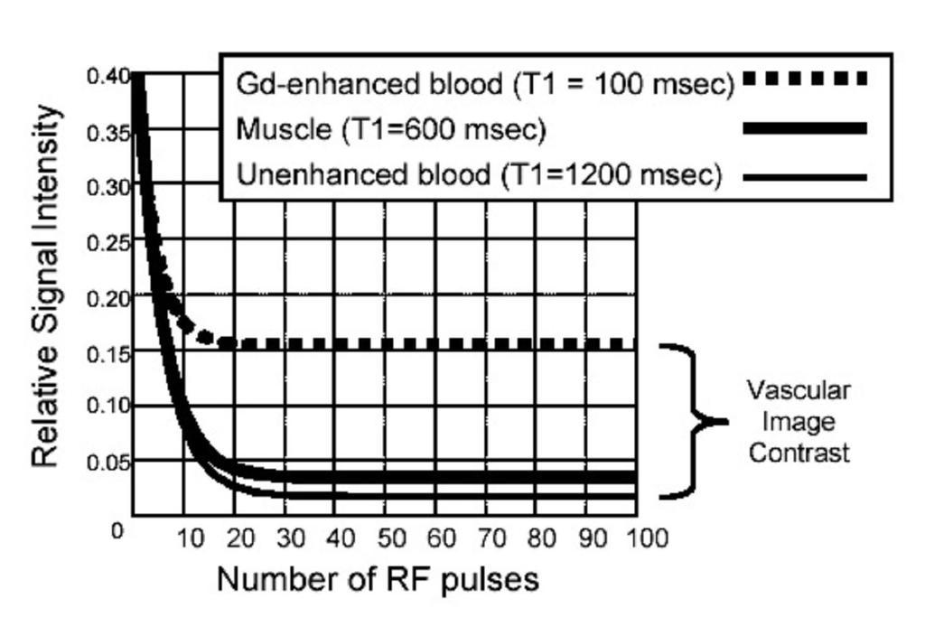 T1 lühenemine kontrastaine mõjul 1/T 1(veri+Gd) = 1/T 1(veri) + a*c(gd) a = Kontrastaine relaksatiivsus C = Kontrastaine kontsentratsioon Gd sisaldus veres lühendab selle T 1