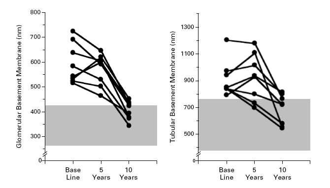 NEJM,