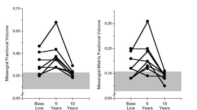 NEJM,