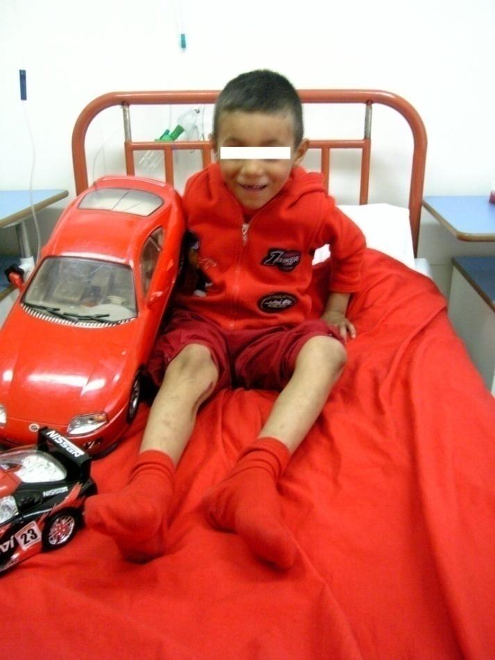 ΑΝΤΙΜΕΤΩΠΙΣΗ ΤΗΣ ΜΠΕΜΠΕΛΗΣ!! Ο μικρός ασθενής είναι ντυμένος στα κόκκινα όπως και τα σεντόνια του αλλά και ότι αντικείμενο κρατά.