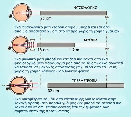 Πρεσβυωπία 8 Αδυναμία