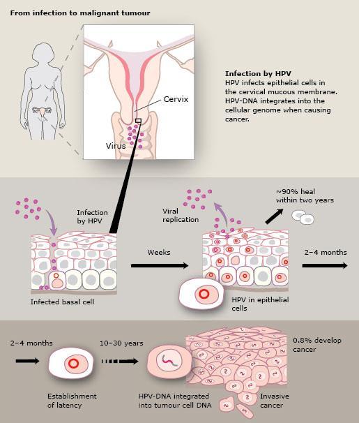 Μόλυνση από ΗΡV O HPV μολύνει τα επιθηλιακά κύτταρα του τραχηλικού βλεννογόνου.
