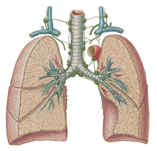 Pneumokoniooside patogeneesi põhimõtted Alveoolidesse inhaleeritud tolm makrofaagidesse Osa makrofaagidest liigub terminaalsetesse bronhioolidesse astsendeeruvalt neelu (neelatakse või