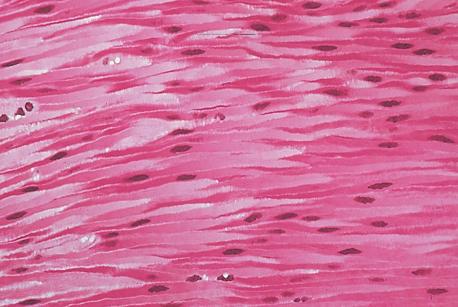 Κάθε τενόντιο όργανο Golgi αποτελείται από τις απολήξεις μιας προσαγωγού νευρικής ίνας οι οποίες εισχωρούν στις δεσμίδες ινιδίων κολλαγόνου του συνδετικού ιστού που συνιστά τον τένοντα και