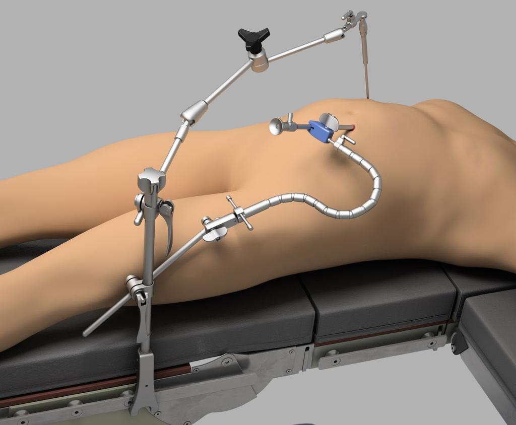 Uncompromised Exposure Laparoscopic User Manual: