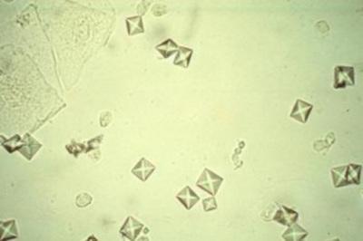 Η μικροσκοπική παρατήρηση αφορά παρουσία ερυθρών και λευκών αιμοσφαιρίων, κρυσταλλικών σχηματισμών από άλατα, κυλίνδρων, επιθηλιακών κυττάρων και μικροοργανισμών (εικόνα 6).