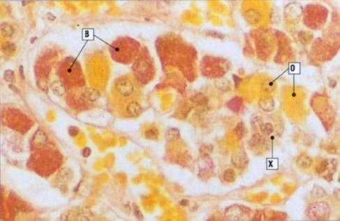 Ταυτοποίηση των κυττάρων της αδενοϋπόφυσης με ιστοχημικές μέθοδοι: - οξύφιλα (χρώση του κυτταροπλάσματος με όξινες χρωστικές) - βασίφιλα (χρώση του κυτταροπλάσματος με βασικές χρωστικές και με τη