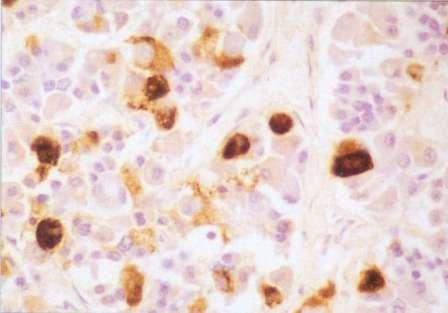 κορτικοτρόπα (14-20% των κυττάρων του πρόσθιου