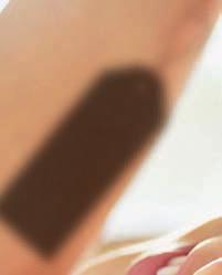Το Serox Lip Optimizer χαρίζει νεανική όψη, με έως και 15% περισσότερο όγκο στα χείλη*!