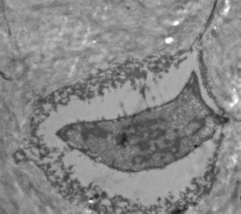 Senescence Intrinsic or replicative (telomere shortening) Extrinsic or stress induced (oxidative