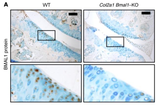 The chondrocyte clock gene Bmal1 controls cartilage