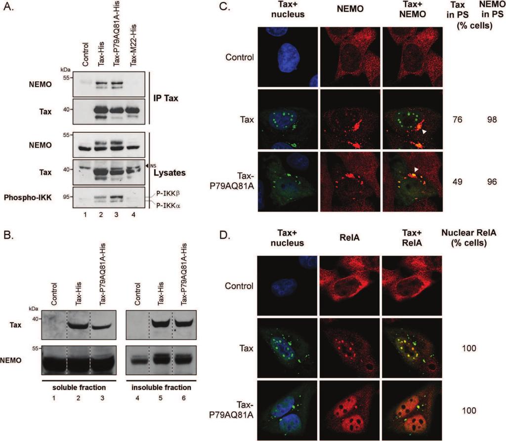 Bonnet et al. Retrovirology 2012, 9:77 Page 5 of 16 http://www.retrovirology.com/content/9/1/77 Figure 3 Tax-P79AQ81A activates the cytoplasmic steps of the NF-κB pathway.