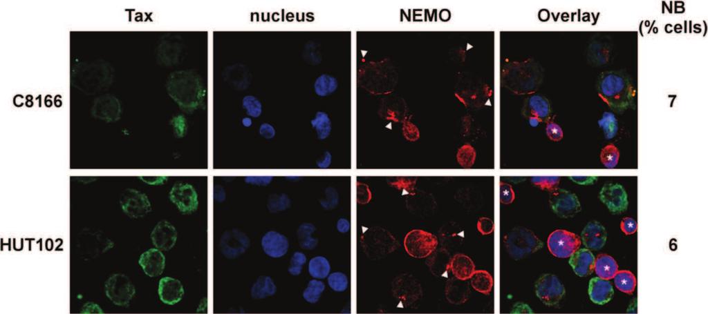 Bonnet et al. Retrovirology 2012, 9:77 Page 7 of 16 http://www.retrovirology.com/content/9/1/77 Figure 5 Tax nuclear bodies are not detected in HTLV-1-infected T cell lines.