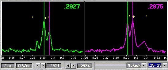 a quadruol error leads to a shift of the tune: s0+ l Δkβ () s Δklquad β Δ Q= ds 4π 4π s0! the tune shift is roortional to the β-function at the quadruole!