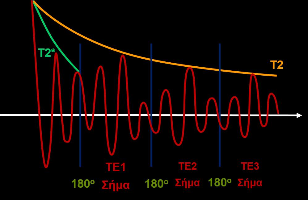 Gradient Echo Ακολουθία παλμών (GE) Δημιουργήθηκαν για να μειώσουν τον χρόνο εξέτασης των ασθενών.