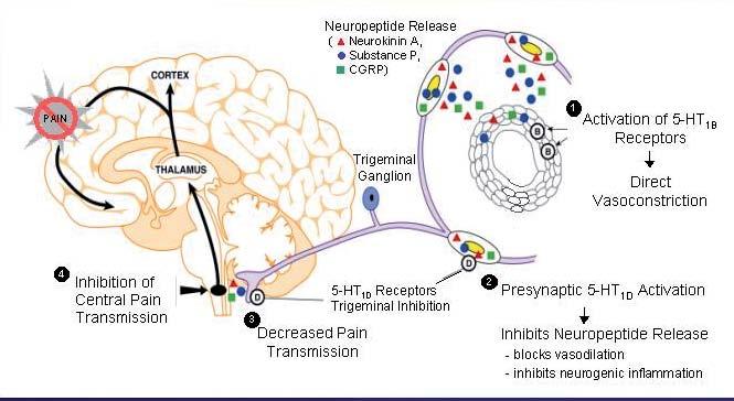 תמונה מס 1: המערכת הטריגמינו-וסקולרית, יצירת הדלקת הנוירוגנית ואתרי הפעולה של הטריפטנים מהם כנגד דרלין ופלצבו הראה יעילות דומה לזו של דרלין במניעת מיגרנה.