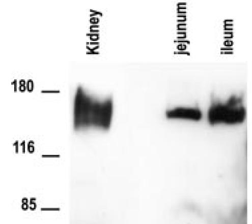RT-PCR Western Blot IHC In vitro η