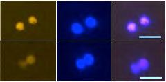 ... IKZF High cells % IKZF High cells B Relative expression/si f/f si f/f!